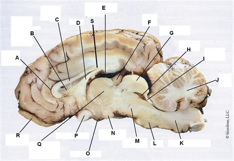 Also, the sheep brain is oriented anterior to posterior (more horizontally), while the human brain is oriented superior to interior (more vertically. . Sheep brain dissection labeling quiz